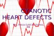 Cyanotic Heart Defects