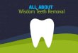 Factors Determining Wisdom Teeth Removal Cost in Sydney