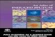 An Atlas of INDUCED SPUTUM an Aid for Research and Diagnosis, 2004, Pg