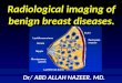 Presentation1.pptx, radiological imaging of beign breast diseases