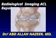 Presentation1.pptx, radiological assessment of acl graft