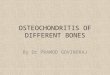 Osteochondritis of different bones