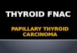 Thyroid fnac