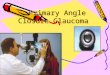 Primary Angle Closure Glaucoma for UGs