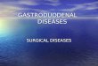 Powrerpoint: Gastro-duodenal surgical diseases