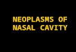 Neoplasms of nasal cavity and nasal polypi