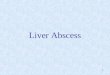 Liver Abscess (1)