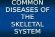 common diseases/disorders of the skeletal system