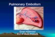 Pulmonary embolism,overview