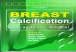 Breast Calcification- A Diagnostic Manual