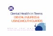 2. Teen Oral Health - Mouth Guards