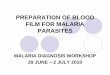 Preparation of blood films for malaria parasites