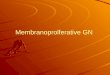 Membranoprolferative GN