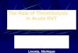The Role of Thrombolysis in Acute DVT