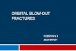 Orbital blow out fractures