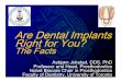 Microsoft PowerPoint - are dental implants right for you