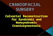 Craniofacial surgery Dr Milan Knezevic