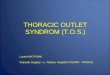 THORACIC OUTLET SYNDROM (TOS)