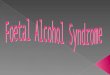 Fetal Alchohol Syndrome