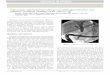 EndoHPB GIE Article in Press April 2011-Dr Reddy_DM