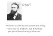 X-Ray? WilhelmWilhelm accidently discovered the X-Ray. There was no problem, but it did help people with technology advances