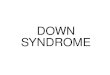 DOWN SYNDROME. non-disjunction - the failure of homologs or sister chromatids to separate properly to opposite poles during meiosis or mitosis aneuploidy