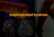 Antiphospholipid Syndrome. Prof. Dr. Suchitra N. Pandit MD, DNBE, DFP, FRCOG, FICOG, B.Pharm Consultant Obstetrician & Gynaecologist Kokilaben Dhirubhai