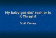 My baby got dat rash or is it Thrash? Scott Carney
