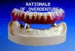 Rationale of Over Dentures - Copy