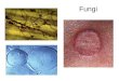 Fungi. FUNGI We have already learned about Bacteria, Viruses, and Protists Now its time to study Fungi MICROBES: 1.Viruses 2.Bacteria 3.Protists 4.Fungi