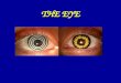 THE EYE. Section through a mammalian eyeball Sclera Choroid Retina Vitreous humour Blind spot Optic nerve Fovea (yellow spot) Ciliary muscle Iris Cornea