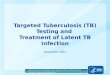 Targeted Tuberculosis (TB) Testing and Treatment of Latent TB Infection December 2011 National Center for HIV/AIDS, Viral Hepatitis, STD, and TB Prevention