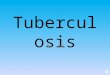 Tuberculosis By: SG Definition infectious disease that can affect almost any part of the body but mainly affects the lungs pulmonary tuberculosis caused