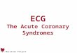 Macstrak Project ECG The Acute Coronary Syndromes