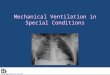 Mechanical Ventilation in Special Conditions. Mechanical Ventilation: Outline Head injury Chest Trauma Bronchopleural Fistula