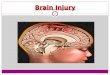 Brain Injury 1. Concept Map: Selected Topics in Neurological Nursing PATHOPHYSIOLOGY Traumatic Brain Injury Spinal Cord Injury Specific Disease Entities: