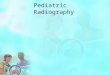 Pediatric Radiography. Children do not all reach a sense of understanding at the same predictable age. This ability varies from child to child, and the