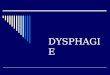 DYSPHAGIE. 1 – Définition 2 – Physiologie 3 – Diagnostic clinique 4 – Diagnostic différentiel 5 – Examens complémentaires 6 – Diagnostic étiologique