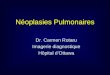 Néoplasies Pulmonaires Dr. Carmen Rotaru Imagerie diagnostique Hôpital dOttawa