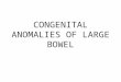 Congenital Anomalies of Large Bowel (Eg)