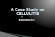 48455757 CASE STUDY 2011 Cellulitis