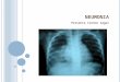 N EUMONIA Presenta Ivonne Zagal. N EUMONIA Inflamación del parénquima pulmonar Causa más importante de morbimortalidad infantil a nivel mundial