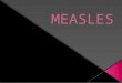 Measles - PHC
