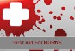 Burns first aid