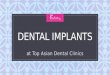 World Class Dental Implants at Top Asian Dental Clinics