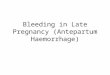 Bleeding in late pregnancy (antepartum haemorrhage)