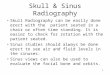 Week 1 skull & sinus & intro to digital 105