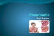 Pneumonia regi
