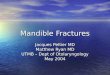 Mandible fx-slides-040526