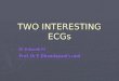 Two Interesting ECGs
